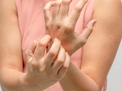 8 BỆNH DA CÓ NGUY CƠ LÂY NHIỂM CẦN CẢNH GIÁC