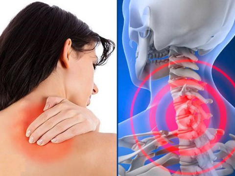 TRIỆU CHỨNG CỦA BỆNH ĐAU VAI GÁY