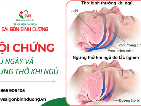 Hội chứng ngủ ngáy và ngưng thở khi ngủ - Tác hại, cách phòng ngừa hiệu quả