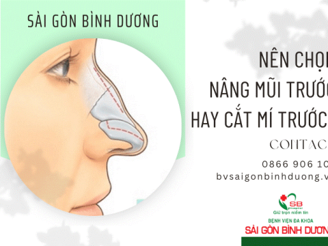 Nên chọn nâng mũi trước hay cắt mí trước? Đâu là lựa chọn đúng?