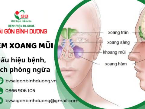 Những dấu hiệu điển hình của người bị viêm xoang mũi và cách phòng ngừa