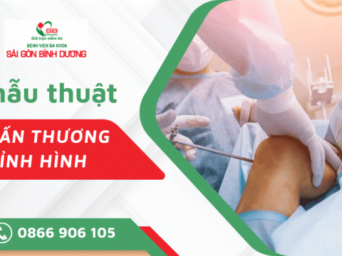Những điều cần biết về phẫu thuật chấn thương chỉnh hình