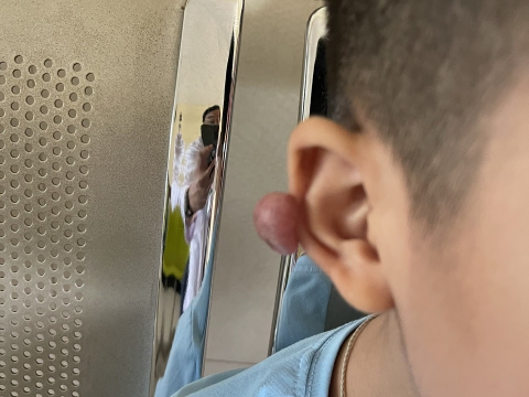 Nhân một ca phẫu thuật cắt bỏ sẹo lồi và may chỉnh hình vành tai cho bé 9 tuổi tại Bệnh viện Đa khoa Sài Gòn Bình Dương.