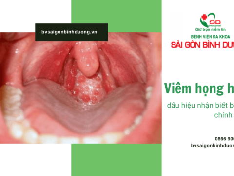 Viêm họng hạt là gì? 6 dấu hiệu giúp bạn nhận biết bệnh chính xác